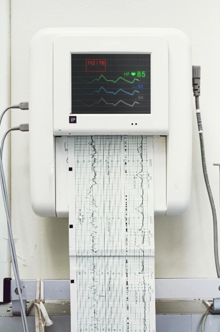 Zdjęcie elektrokardiogramu (EKG)