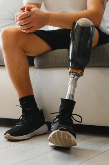 Zdjęcie pacjenta po amputacji, który zgłosił się na rehabilitację